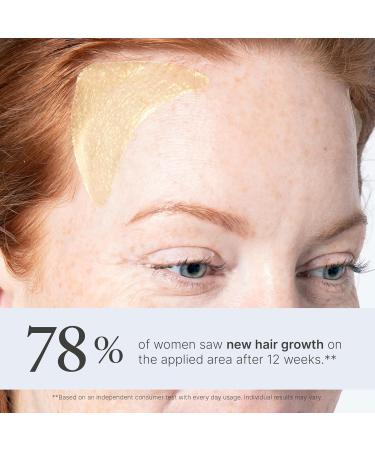 Buy Superpower Thickening Hairpatches - Boost Volume & Confidence | International Shipping Available - Buy Online on GoSupps.com