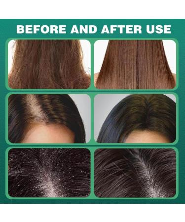 Ce pain de shampoing naturel l'usmanthus apaise et fortifie les cheveux. Enrichi en huiles essentielles de romarin et d'arbre th il produit une mousse onctueuse et est facile transporter 2Pcs - Buy Online on GoSupps.com