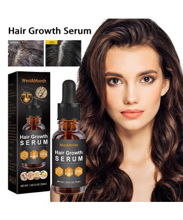 Nchampionba Allurium Hair Growth Serum with Chebe for Black Women - Revitalize Thinning Hair - 2pcs - Buy Online on GoSupps.com