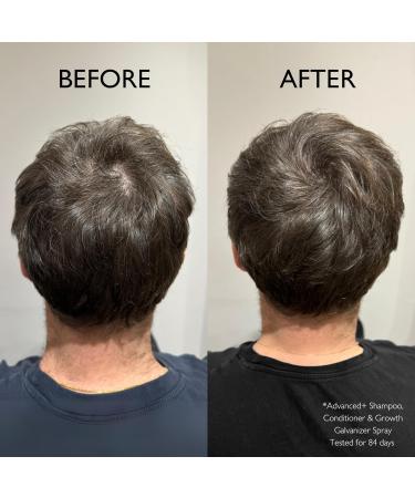 Daimon Barber Hair Growth Galvanizer Spray | Reduce Hair Loss & Promote Thicker Hair | 100ml for Thinning Hair - Buy Online on GoSupps.com