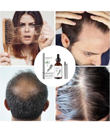 Rosemary Hair Oil Natural Hair Oils For Hair Growth Hair Growth Oil For Women Rosemary Oil For Hair Growth 60ml For Thin Hair - Buy Online on GoSupps.com