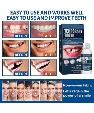Temporary Tooth Repair Kit | WTTFC Tooth Filling Thermal Pearls & Veneer Replacement - Safe Easy Tooth Fix for Broken Teeth - Buy Online on GoSupps.com
