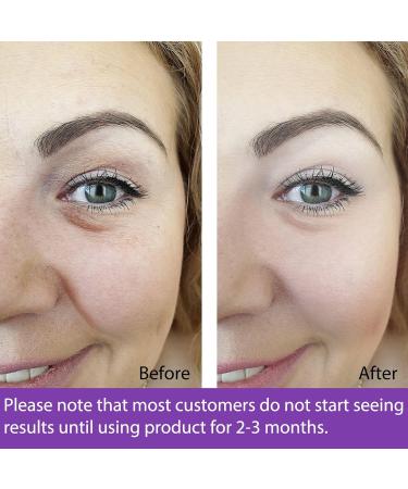 Retinol Moisturizer Cream COMPATH Anti-aging Wrinkle Night/Day Cream for Eye and Face Reduces Wrinkles and Fine Lines with 2.5% Active Retinol Hyaluronic Acid (1.7FL(Oz)) - Buy Online on GoSupps.com