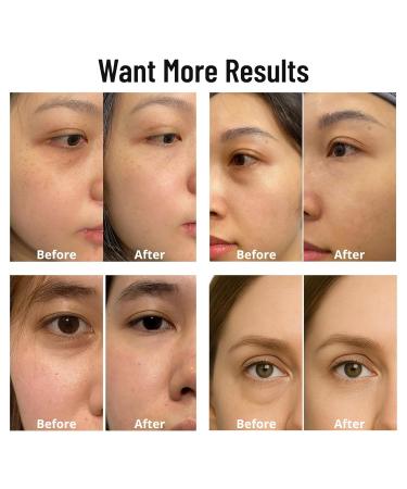 Caffeine 5% + Bakuchiol Eye Serum for Dark Circles Puffiness Eyes with Argireline & Copper Peptides (GHK-Cu) Roll-on Under Eye Serum Anti-Aging Wrinkle Care for Fine Lines 20ml - Buy Online on GoSupps.com