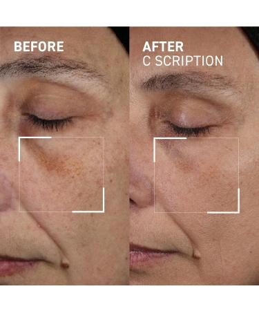 Dr. Brandt Bright This Way C Scription - Concentrated Vitamin C Serum - Fade Dark Spots Reduce Wrinkles & Illuminate Skin Tone - 1 fl oz 1 Fl Oz (Pack of 1) - Buy Online on GoSupps.com