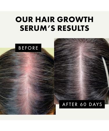 Hair Growth Serum - Hair Serum for Dry Damaged Hair Hair Serum for Frizzy Hair - Biotin Oil Hair Anti Frizz Hair Serum for Men and Women Sulphate Free Vegan - Buy Online on GoSupps.com