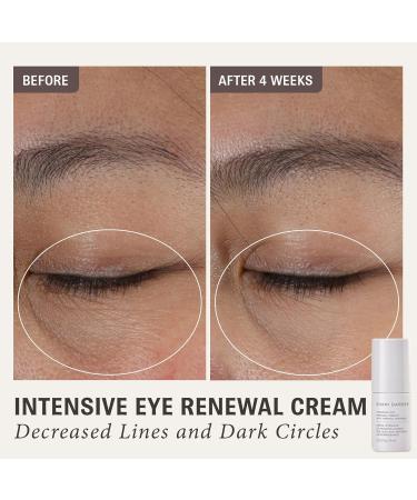SHANI DARDEN Intensive Eye Renewal Cream - Target Fine Lines & Dark Circles 0.50 fl oz - Buy Online on GoSupps.com