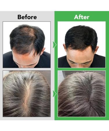  Bibonse Rosemary shampoo with rosemary oil for hair growth vegan rosemary oil against hair loss stimulates hair growth anti-hair loss shampoo - Buy Online on GoSupps.com
