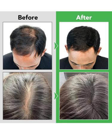 Rosemary Shampoo for Hair Growth | Vegan Rosemary Mint Shampoo with Biotin | Gentle Scalp Nourishing & Repairing Formula - 300ml - Buy Online on GoSupps.com
