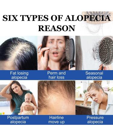 Pegciz Scalp Serum Revitalizer with Argan Oil, Biotin, Caffeine, Stem Cell, Catalase & DHT Blockers - For All Hair Types, Men & Women - Buy Online on GoSupps.com