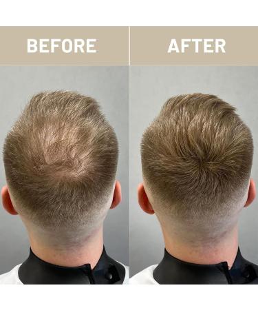 VOLLUCK Hair Fiber for Thickening - Long-lasting Natural Hair Products for Men & Women - 28g Gray | Hair Loss Solutions - Buy Online on GoSupps.com