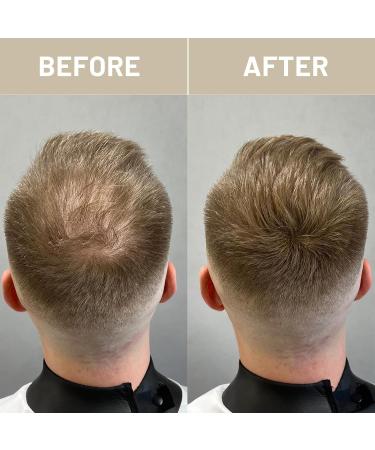 VOLLUCK Hair Fiber for Thickening - Long-lasting Natural Hair Loss Solution for Men & Women - 28g Black - Buy Online on GoSupps.com