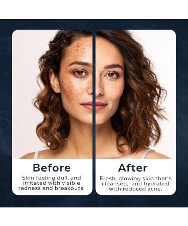 Neptune Black Sea Mud Scrub 3 Fl Oz | Deep Cleansing & Exfoliating Face Scrubber for Acne Razor Bumps & Redness | Hydrates & Soothes Skin with 100% Natural EWG Verified Ingredients - Buy Online on GoSupps.com