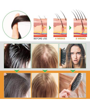 3 in 1 Shampoo and Conditioner with Biotin Rosemary Oil Black Castor Oil and Batana 2 x 10.56 fl oz Shampoos and Conditioners to Strengthen and Restore Brittle Hair (#3) - Buy Online on GoSupps.com