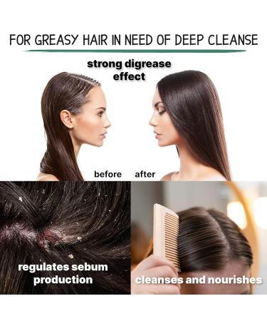 Nettle Shampoo for Healthy Hair - Regulates Sebum Reduces Dandruff & Soothes Scalp Irritation - 200ml | International Shipping Available - Buy Online on GoSupps.com