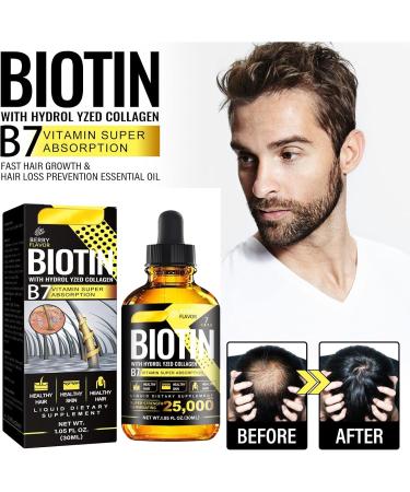 Nourishing Hair Strengthening Oil Hair Repair Oil Hair Strengthening Oil Hair Essential Oil Hair Growth Oil Nourishing Hydrating Hair Growth Vitamin B7 Hair Growth Oil for Men Hairless 30ML - Buy Online on GoSupps.com