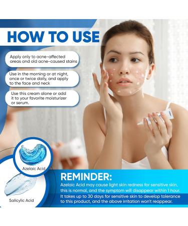 AOBBIY Azelaic Acid Cream: Azelaic Acid For Face - Premium Azelaic Acid Cream - Face Skin and Beauty Care - Azelaic Acid Facial Cream (1 Oz) - Buy Online on GoSupps.com