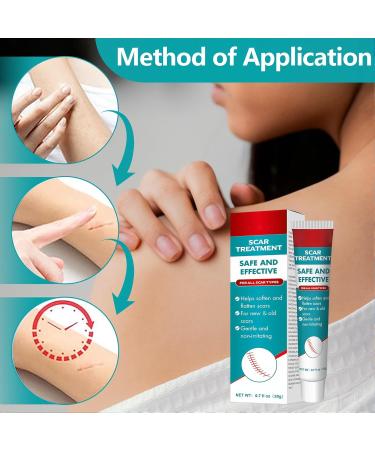 WIDYA Scar cream 20 g promote wound healing acne ethics keloids cesarian - Buy Online on GoSupps.com
