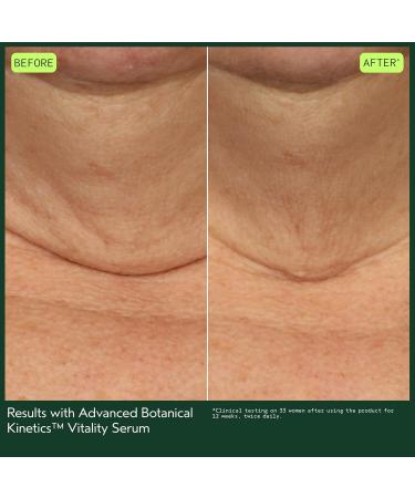 Aveda Advanced Botanical Kinetics Vitality Serum | Reduces the look of fine lines and wrinkles | Vegan | Full Size | 1 Fl Oz - Buy Online on GoSupps.com