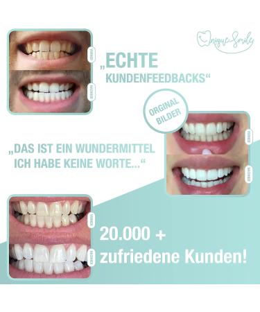 High-Quality Teeth Whitening Kit | UniqueSmile All-in-One Tooth Bleaching Set for White Teeth - Buy Online on GoSupps.com