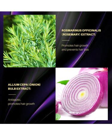 Onion Shampoo Strengthens Hair & Revitalizes Hair for Thinning Hair & Hair Loss Soft & Shiny & Reduces Frizz Moisturizes & Restores for All Hair Types - Buy Online on GoSupps.com
