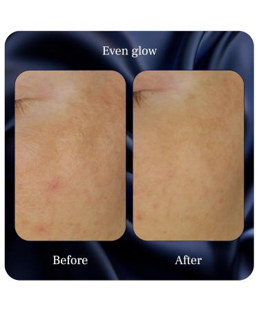 Even Glow - Organic Vitamin C Serum for Dark Spots on Face - Dark Spot Corrector Dark Spot Remover for Face & Body - with Kakadu Plum Extract Maple Leaf Extract Aloe Leaf Juice & More - 1 Fl Oz - Buy Online on GoSupps.com