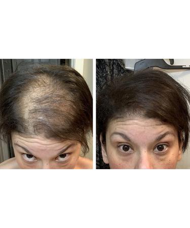 Dark Brown Hair Loss Concealer Trial Size - Cover Bald Spots Instantly - 10-Day Supply - All-Natural Fiber Formula - Buy Online on GoSupps.com