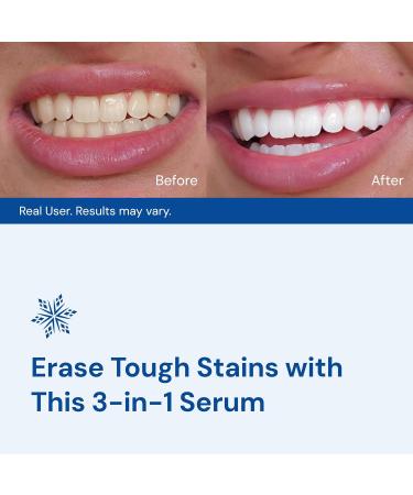 SNOW DiamondSeries Wand - Strengthen & Repair Enamel While Whitening Teeth | International Shipping Available - Buy Online on GoSupps.com