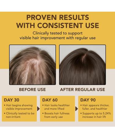 Raw Batana Oil for Hair Growth - 100% Pure Organic 3.5 fl oz Batana from Honduras for Thick and Strong Natural Hair - Dr. Sebi Unrefined Cold Pressed Cosmetic Scalp Mask Gifts for Women (1 Pack) - Buy Online on GoSupps.com