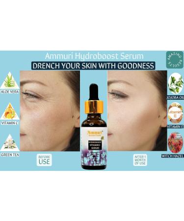 Hydroboost ORGANIC Vitamin C Serum with Hyaluronic Acid - High-Dosed - 30% Vitamin C + Hyaluronic Acid with Herbal Infusion Vitamin E & Aloe Vera - 100% Vegan for Anti-Ageing Face & Skin Care - Buy Online on GoSupps.com