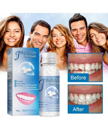 Temporary Smile Glue (30g) for Denture Repair - White, One Size - Dental Adhesive for Missing, False, or Bonding Teeth - Buy Online on GoSupps.com