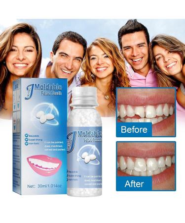 Temporary Adhesive Kit for Missing Denture Teeth Repair - Smile Confidently with False Teeth Straightener (30g, White) - Buy Online on GoSupps.com