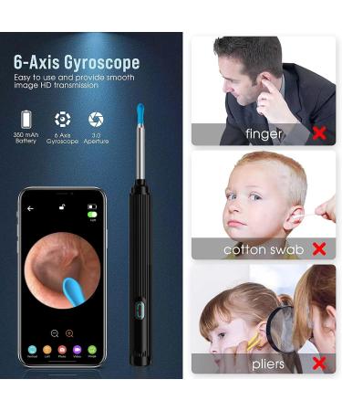 Ear Wax Removal Tool Camera, Wireless Ear Cleaner with 1080P Otoscope & LED Light, Visual Earwax Removal Kit with Soft Silicone Tips, Ear Camera for iOS & Android (Black) - Buy Online on GoSupps.com