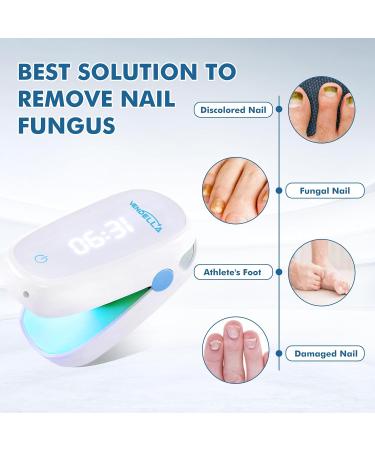 VENDELLA Rechargeable Nail Fungus Treatment Laser - For Onychomycosis, Discolored Nails & Cracked Toenails - Buy Online on GoSupps.com