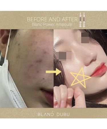 NUBORN CELL Blanc Power Ampoule | Milk Protein Extract | Hyaluronic Acid Complex | 7ml x 5ea - Buy Online on GoSupps.com