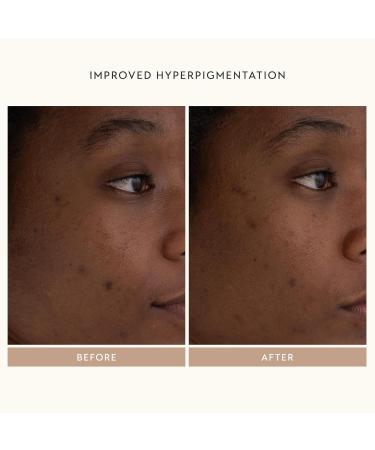 SHANI DARDEN SKINCARE Retinol Reform Duo - Anti-Aging Resurfacing Serum for Face & Neck | Full & Travel Size | Fine Lines & Wrinkles Treatment - Buy Online on GoSupps.com