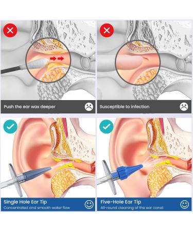 Buy Ear Syringe for Effective Ear Wax Removal - Irrigation Syringe for Safe Ear Cleaning - Buy Online on GoSupps.com