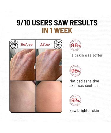 Arabica Coffee Body Scrub with Vitamin E - Exfoliating Scrub for Women, Cellulite, Acne & Stretch Marks - Buy Online on GoSupps.com