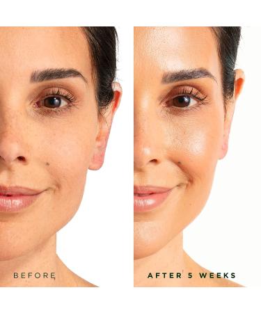 Tree of Life Vitamin C Brightening Facial Serum with Vitamin E - 1 Fl Oz - Buy Online on GoSupps.com