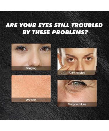 Retinol Eye Cream Stick for Under Eye Bags Eye Balm Moisturizes Hydrating for Dark Circle Wrinkles Undereye care for Women Girl - Buy Online on GoSupps.com