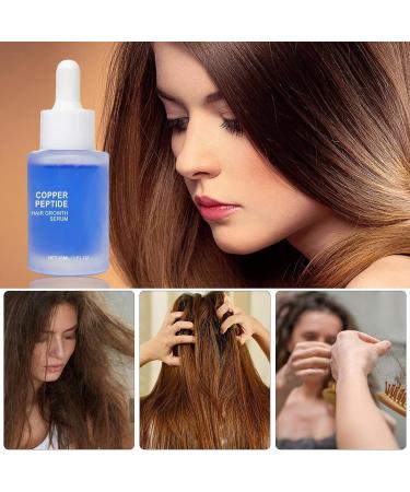 Scalp Essence Hair Growth | Hair Growth Oil Women | Hair Essence Repair Solution Hair Thickening Cures Women Hair Growth Serume Thinning Hair Hair Growth Suitable Use for Women - Buy Online on GoSupps.com