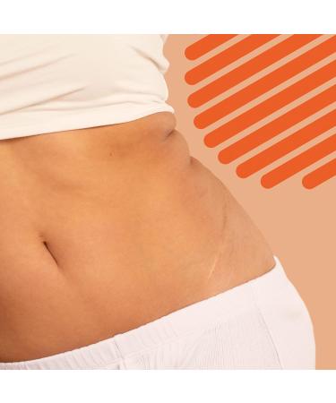 Bio-Oil Skincare Bundle Original | Skincare Oil 200ml and Bio-Oil Body Lotion 250ml - Buy Online on GoSupps.com