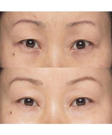 Instant Eye Lift 0.27 oz | Enhance Your Look | Fast International Shipping - Buy Online on GoSupps.com