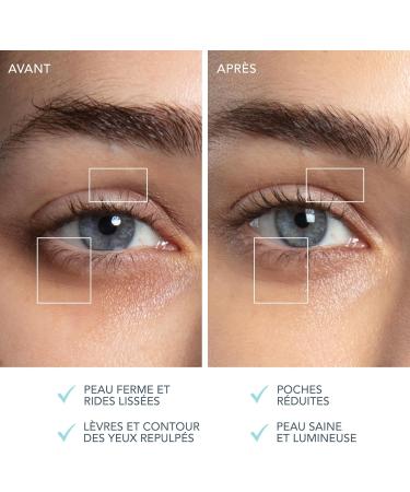 Set FOREO A Wink 'n' a Smile - Appareil anti rides micro-courant BEAR 2 eyes & lips + Serum FOREO SUPERCHARGED Eye & Lip Contour Booster 3x3 5 ml - Traitement anticernes et appareil repulpant l vres Blanc - Buy Online on GoSupps.com