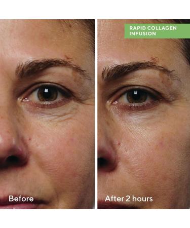Murad Rapid Collagen Infusion - Resurgence Anti-Ageing for Face - Skin Smoothing Cream Targets Deep Wrinkles - Gentle Skin Treatment Backed by Science 30ml - Buy Online on GoSupps.com