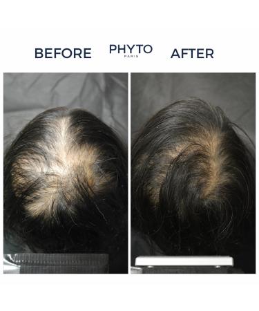 Buy PHYTO Phytonovathrix Botanical Hair Loss Thinning Treatment for Women - Restore Thicker Hair International Shipping Available - Buy Online on GoSupps.com