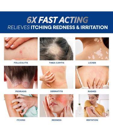 Folliculitis Treatment Cream 100g - Effective Relief for Scalp Face & Body | International Shipping - Buy Online on GoSupps.com