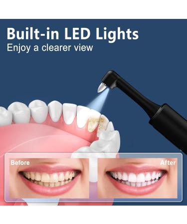 Rechargeable Tooth Polisher | Electric Teeth Cleaning Kit with LED Light | Whitening & Polishing Tools | 5 Brush Heads 4 Speed Modes IPX6 Waterproof - Buy Online on GoSupps.com