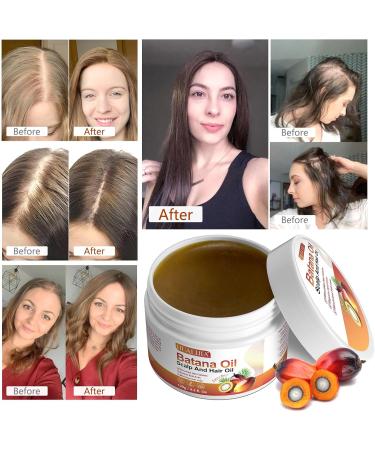 Raw Batana Oil for Hair Growth and Repair Pure & Organic Batana Oil from Honduras Stimulate Hair Growth Prevent Hair Loss and Enhances Hair Thicknes 120g - Buy Online on GoSupps.com