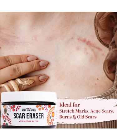 Better Shea Butter Scar Eraser Balm | Cocoa Butter Cream for Stretch Marks Dark Spots & Scars - Natural Ingredients 4 oz - Buy Online on GoSupps.com